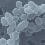 Ruminococcus Flavefaciens